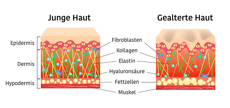faltenbehandlung mit microneedling mit wirkstoffkonzentraten junge haut alte haut augenklinik sulzbach faltenbehandlung mit microneedling mit wirkstoffkonzentraten junge haut alte haut augenklinik sulzbach